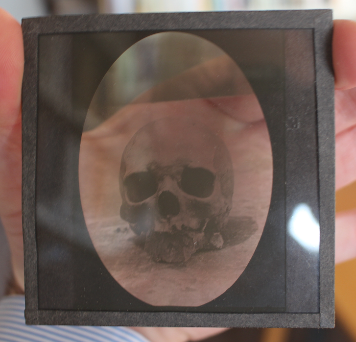 An example of the original glass slides. This particular one shows the photograph of the skull as mentioned above.